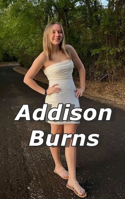 Burns